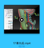 4● 浅环成皮下环g
(四)腹股沟三角
50● 腹股沟三角iguin
又称 Hesselbach
s● 股环限 femoral

wis171

(五)康股沟疝
三、率丸下降
57
【膜籍突vaginali

第三节

$1
食管度部abdon
二、胃一
(一)位置与配

$5
胃stomach
(二)网膜与知
55

17睾丸疝.mp4
02:10