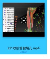 ● 48 2)股管femora
◎ 49 股环femoral ri
◎50 股环隔femonal
●51 3)股动脉femar
D 52 股深动脉di
14161
●53 4)股静脉fernor
54 5)腹股沟深淋日
● 55 6)股神经femor
56 隐神经saph
B8
0 57 5. 收肌管 add
154
58 收肌號裂孔 addi
59 膝降动 脉 desce
6.股内侧区的

7

wan m7 Sa.1

a21收肌管腱裂孔.mp4

03:35