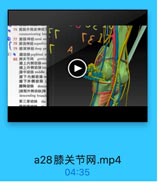一
VVC TIY

76 腓肠外側皮神经三
communicating bra
E 77 排肠神经sural ne
78 時浅神经superfici
79 排深神经deep pe

A

2)

脂动脉 popliteal a
80 滕关节网 genicigs
聯上内側动脉me
肆上外侧动脉Intd
藤中动脉 middle
脖下内側动脉m
脖下外側动脉 1
膝降动脉 desce
[旋股外側动脉]降
descending branch
第三穿动脉 the

a28膝关节网.mp4

04:35
