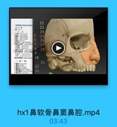 鼻 软 骨 鼻 窦 鼻 腔 .mp4