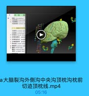 a大脑裂沟外侧沟中央沟顶枕沟枕前切迹顶枕线.mp4