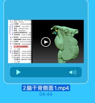 0 14 中滴 midbrain
.. 15 la cerebral peduncle
大脑脚底 cnus cerebri
15 substantia nigra

、 被盖 tegmentum
· 中脑导水管周田灰质 peri
· 中脑顶盖 tectum of midbr
e 18 BU (e] interpeduncular fo
中脑外侧沟 laleral saleas
0 1/ 后穿质 posterior perforat
◎ 1H中脑水管
mesencephalie
2. 脑干的背侧面
(1}延

C.1模束结节

20 薄束结节
cuncate tubercl
gracile tuberele
21 小脑下脚
inferior cerebel
"灰小结节
tuberculum cin
三叉结节 trigeminal tuberg
(2)脑桥

2脑干背侧面1.mp4

04:44