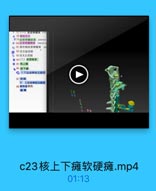 ◎ 78推体交叉
₽79皮质脊结前索 anterior
P-80皮质脊體傳惠 lateral c
o 8I前外侧皮原脊體東
82:交叉前受損
D 83交翼启受担
●84(二】成质桃東
● 85 抗上庫
● 86 栋下條
1.下运动神经元报伤
87 软州
2. 上运动神经元损伤
88 熊体東捐伤

硬康

4504

c23核上下瘫软硬瘫.mp4

01:13